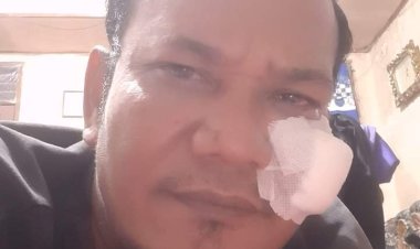 Di Tapteng, OTK Kembali Aniaya Wartawan, Dipukul dan Disayat Senjata Tajam