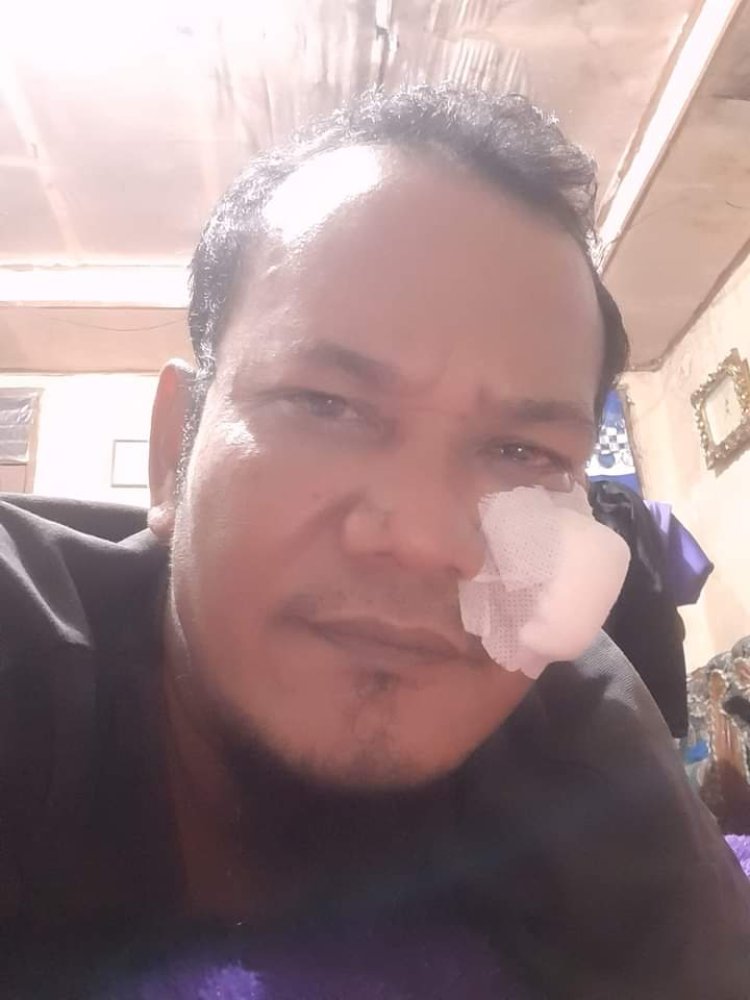 Di Tapteng, OTK Kembali Aniaya Wartawan, Dipukul dan Disayat Senjata Tajam