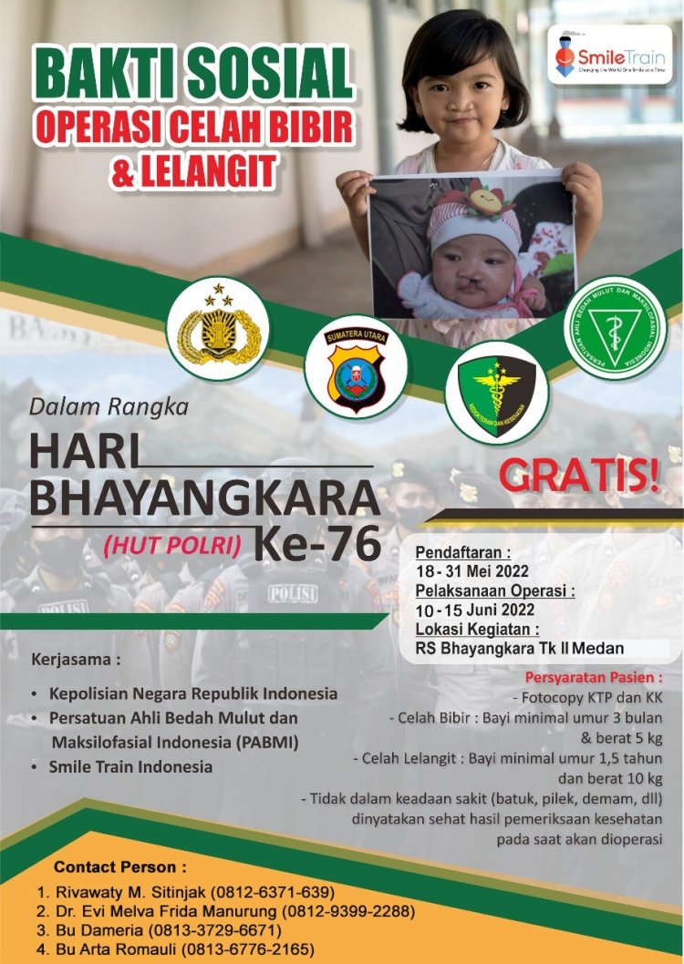 Sambut Hari Bhayangkara Ke 76, Poldasu Gelar Bakti Sosial & Operasi Celah Bibir 