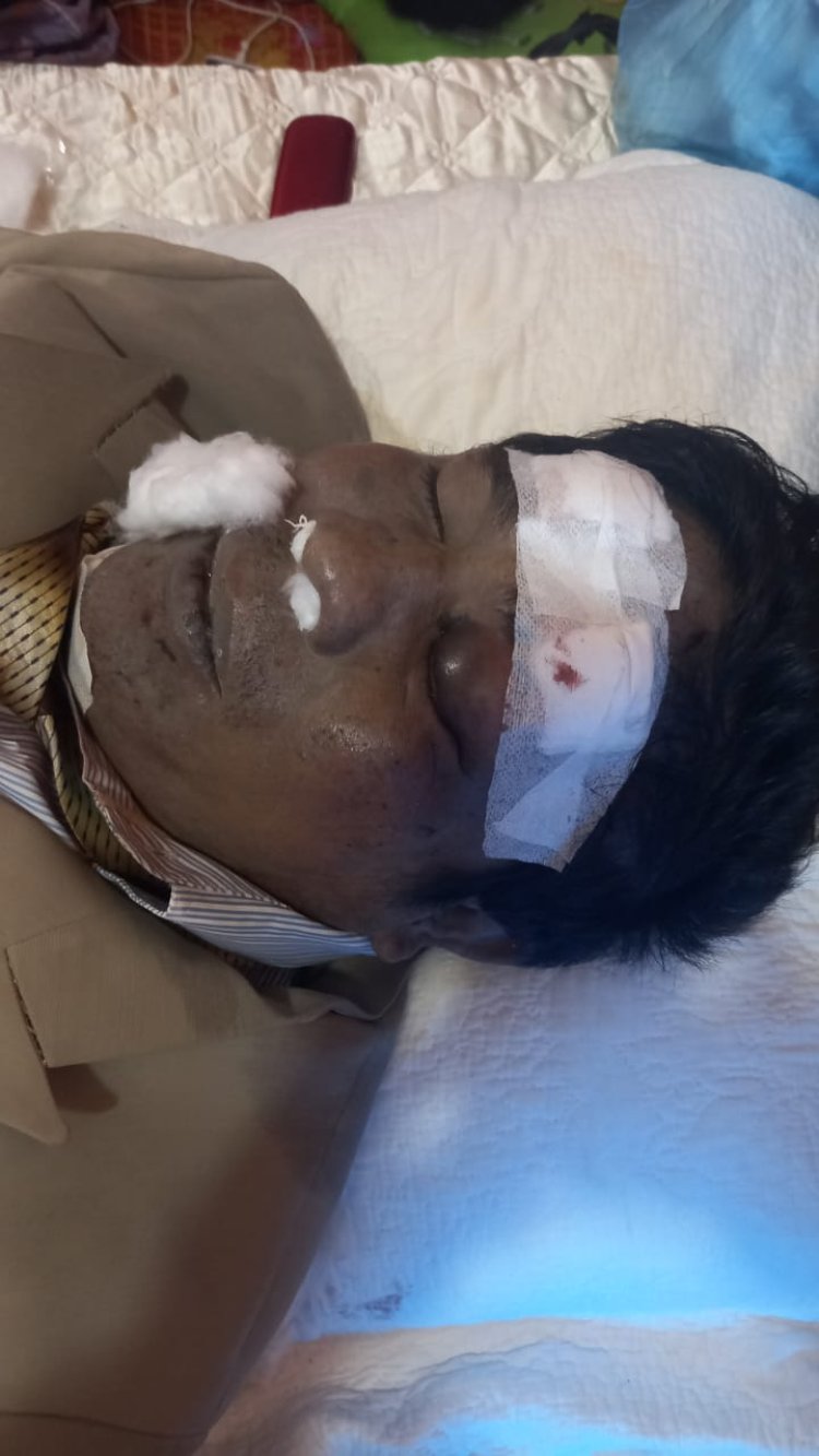 Mantan Tentara Tewas Dengan Banyak Luka, Saat Dijemput Polisi, Kapolres Sibolga " Karena Lari dan Terjatuh"